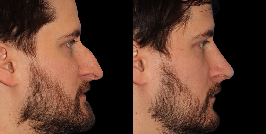 Plastic Surgery Results